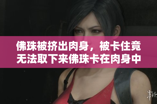 佛珠被挤出肉身，被卡住竟无法取下来佛珠卡在肉身中无法取下，寻找解救方法